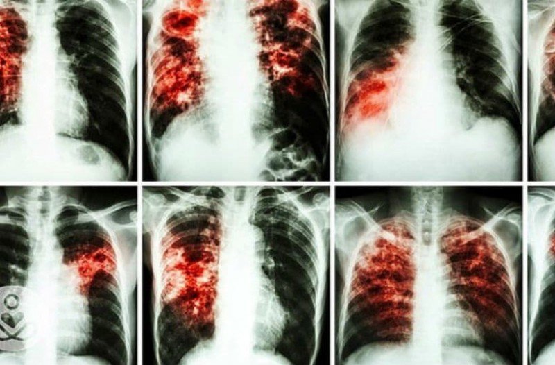 Είναι πιο καρκινογόνα και από το κάπνισμα και όλοι τα χρησιμοποιούμε καθημερινά