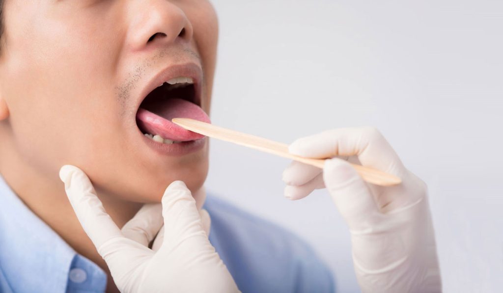 Καρκίνος του στόματος – Σημάδια που δεν πρέπει να παραβλέψετε