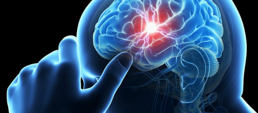 Mίνι εγκεφαλικό: Με ποια συμπτώματα «χτυπάει»
