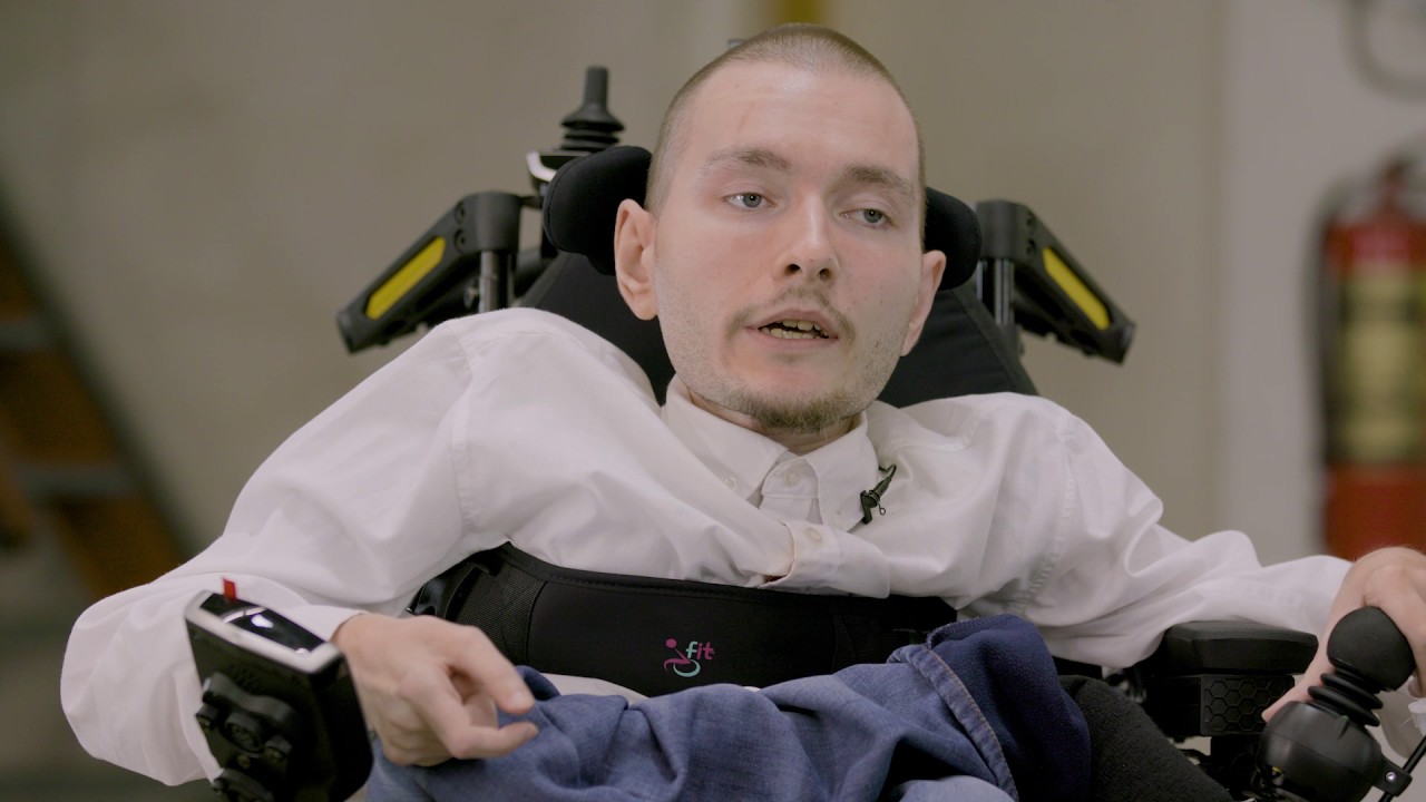 Ο πρώτος εθελοντής για μεταμόσχευση κεφαλιού το μετάνιωσε όταν μια καλλονή Ρωσίδα του «πήρε το μυαλό» (φωτο)