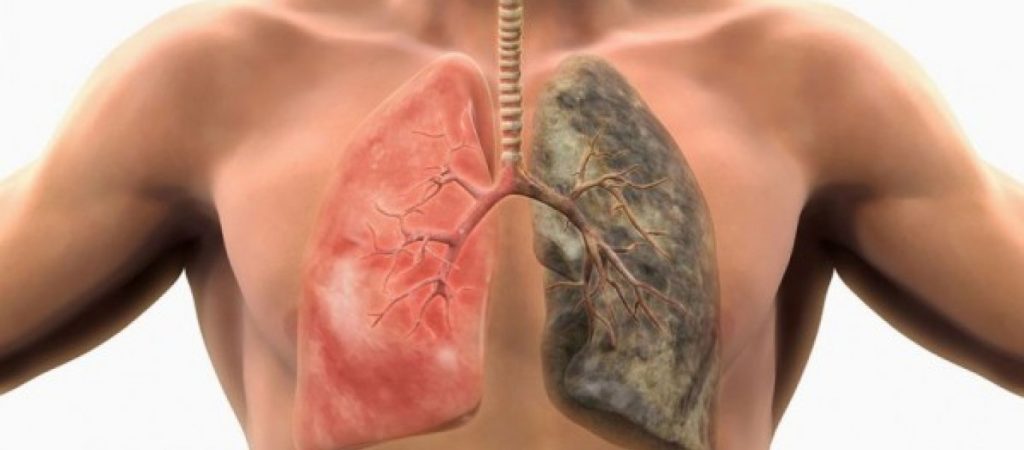 Αυτές οι 6 τροφές καθαρίζουν τα πνευμόνια σας από το τσιγάρο!