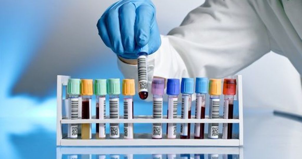 Αλτσχάιμερ: Μια απλή εξέταση αίματος μπορεί να προβλέψει τη νόσο 16 χρόνια νωρίτερα (βίντεο)