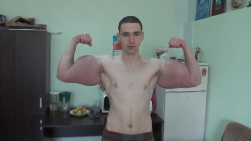 Ρωσία: Νεαρός ξεκίνησε ενέσεις αναβολικών γιατί ήθελε να μοιάσει στον… Ποπάυ! (βίντεο)