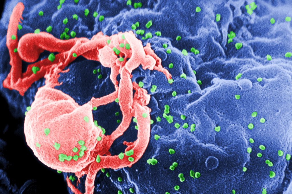 Νοροϊός: Τι πρέπει να γνωρίζουμε για τον ιό που προκαλεί γαστρεντερίτιδα