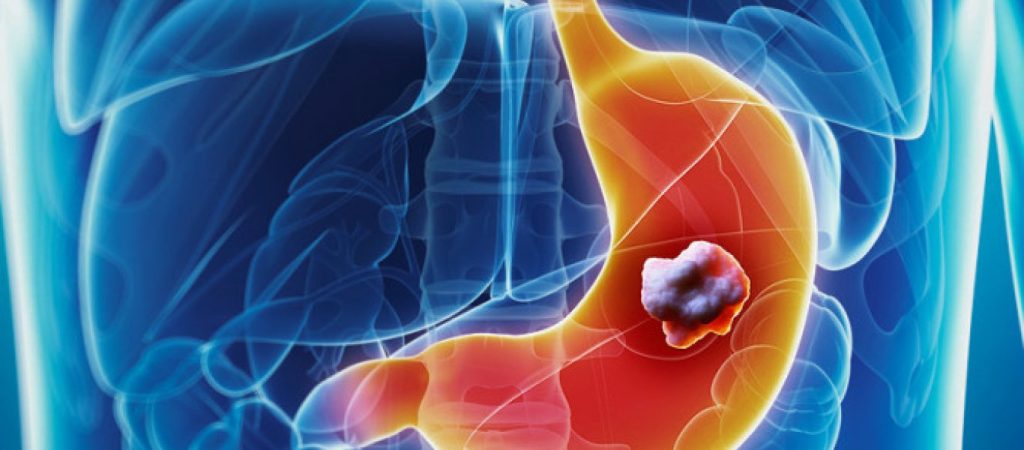 Οι δέκα εντολές για την πρόληψη του καρκίνου – Πώς θα προστατευθείτε