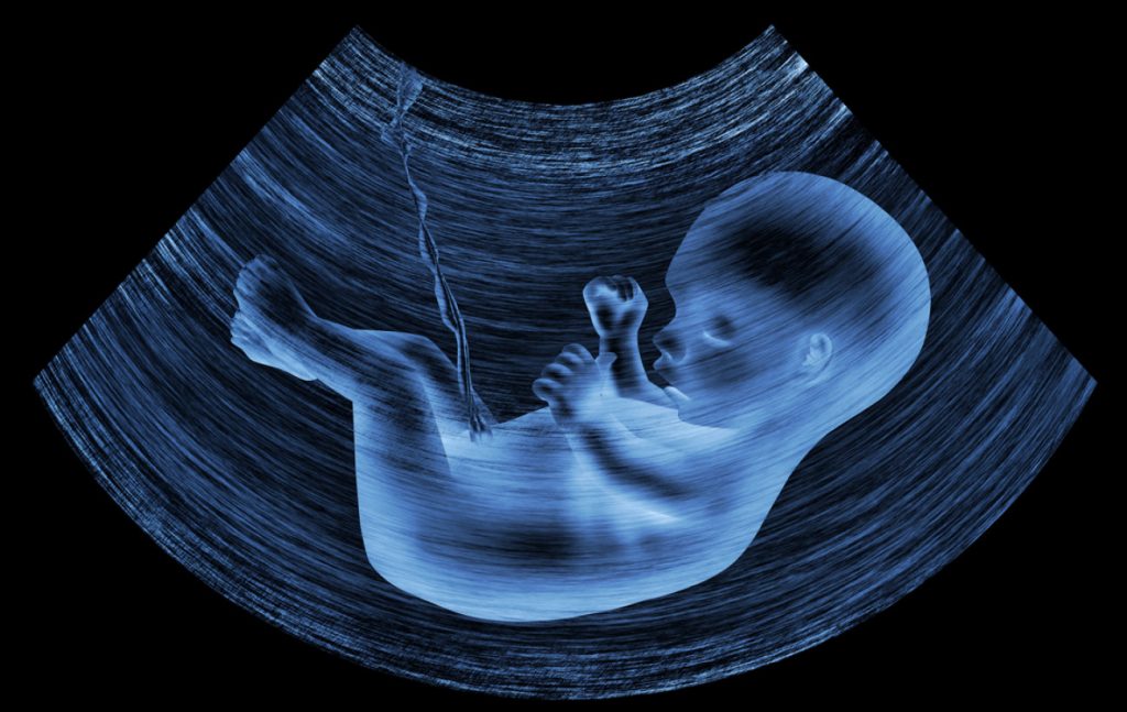 Έγκυος παίρνει την απόφαση να κάνει έκτρωση όταν είδε τον υπέρηχο – Τι αποκάλυψε (φωτό)