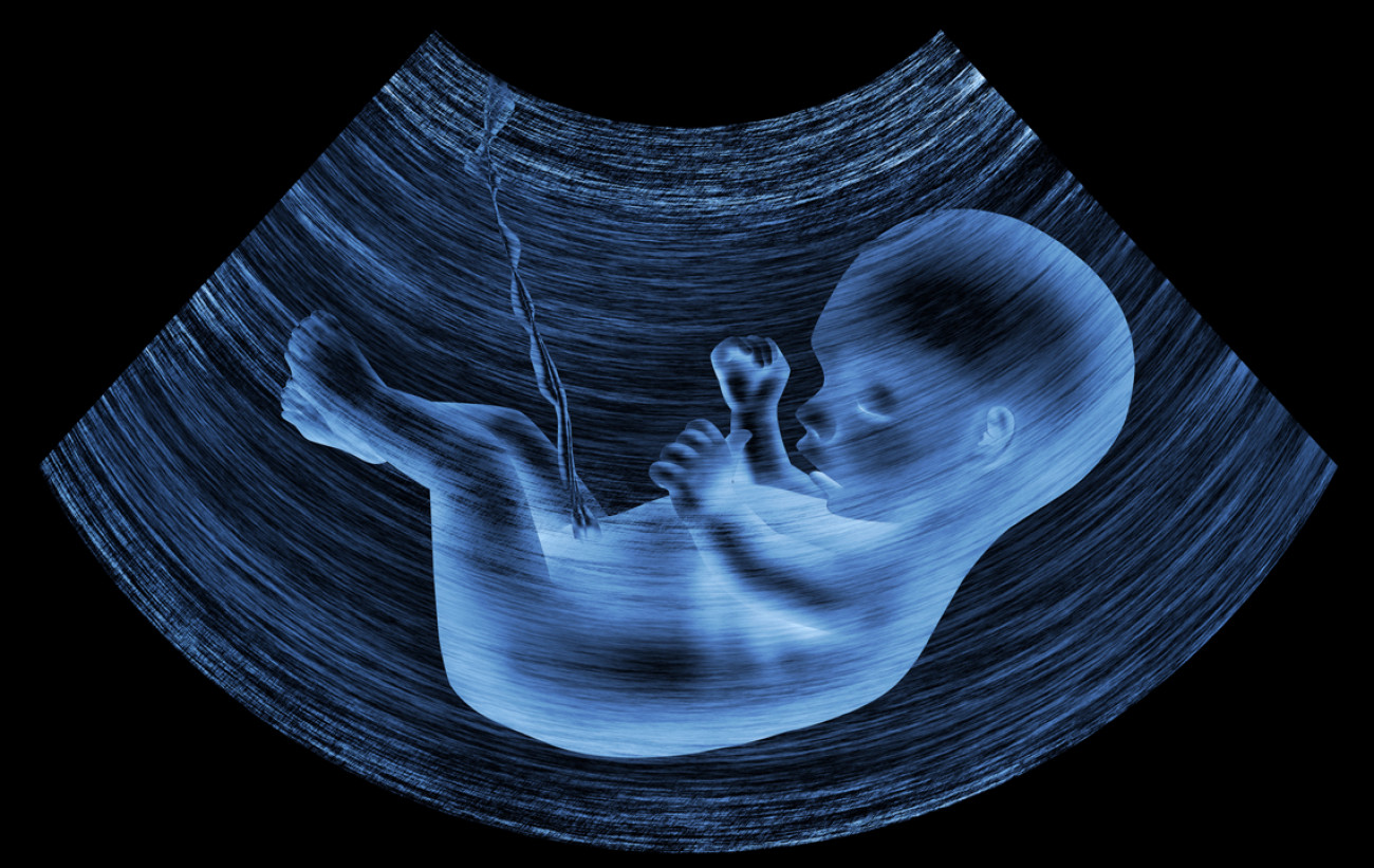 Έγκυος παίρνει την απόφαση να κάνει έκτρωση όταν είδε τον υπέρηχο – Τι αποκάλυψε (φωτό)