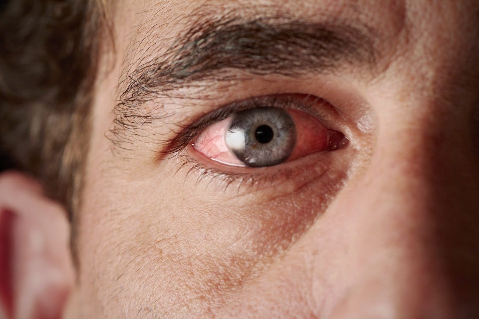 Αυτό το σημάδι στα μάτια μπορεί να είναι πρώιμο σύμπτωμα για… Αλτσχάιμερ