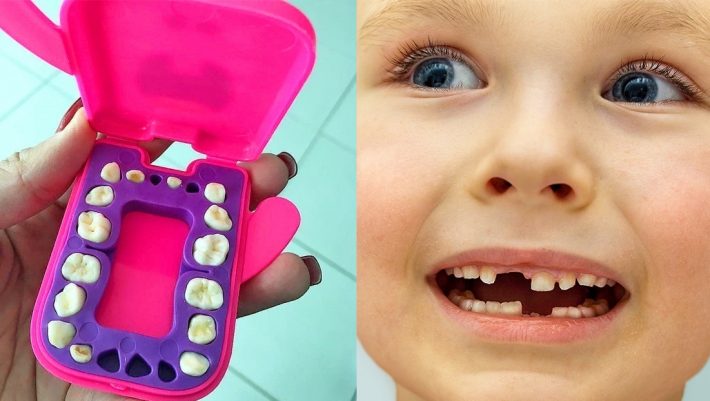 Γιατί οι γιατροί προτρέπουν τους γονείς να κρατάνε τα πρώτα δόντια των παιδιών;
