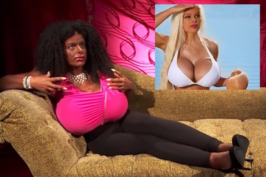 Έχει χαθεί η λογική: Κάνει ενέσεις για να μεγαλώσει το στήθος της και να γίνει… μαύρη (βίντεο)