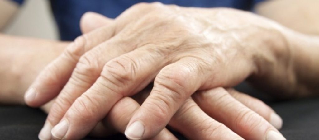 Ουρική αρθρίτιδα: Τι να κάνετε για να μειώσετε το ουρικό οξύ