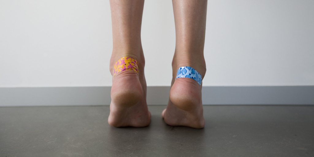 Φουσκάλες στα πόδια: Τα λάθη που κάνετε και τις επιδεινώνουν