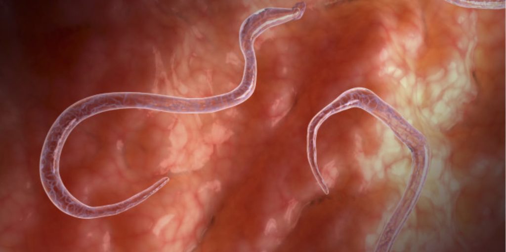 Παράσιτα στο έντερο: Έτσι θα τα καταλάβετε