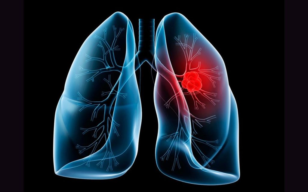 Έτσι θα καθαρίσετε τους πνεύμονές σας σε τρεις μέρες