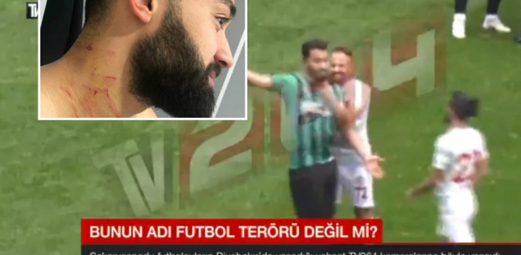 Τουρκία: Ισόβιος αποκλεισμός από το ποδόσφαιρο για τον παίκτη με την λεπίδα (βίντεο)