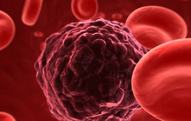 Εφιαλτική πρόβλεψη για τον καρκίνο – Τι λένε ερευνητές για το 2019