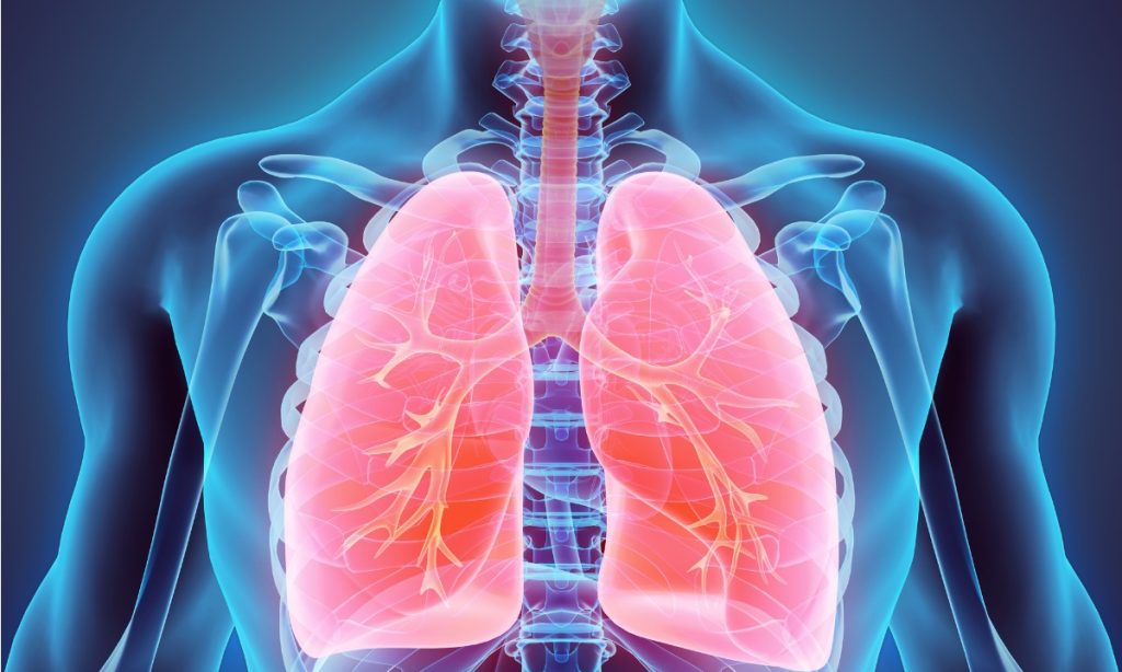 Αν έχετε αυτά τα συμπτώματα… έχετε συσσώρευση υγρού στον πνεύμονα