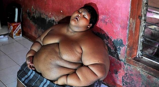 Το πιο παχύ παιδί του κόσμου έχασε 80 κιλά (φώτο)