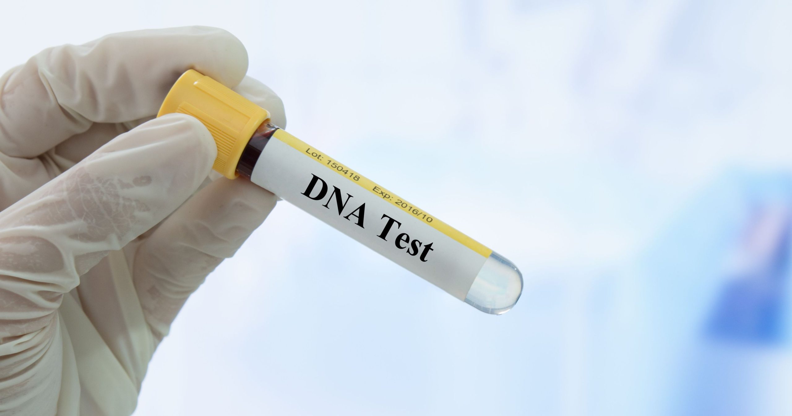 Ζευγάρι έκανε για πλάκα τεστ DNA αλλά τα αποτελέσματα… τους οδήγησαν στον χωρισμό