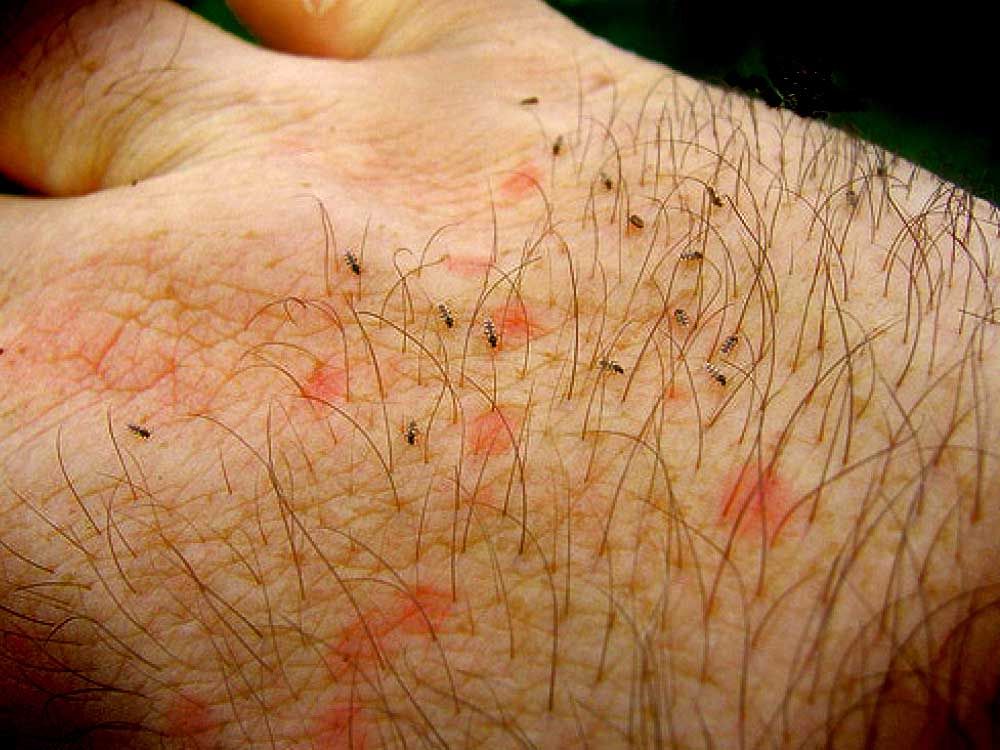 Αστυνομικό τμήμα έκλεισε λόγω επίθεσης… ψύλλων – Οι αστυνομικοί έφυγαν από το τμήμα