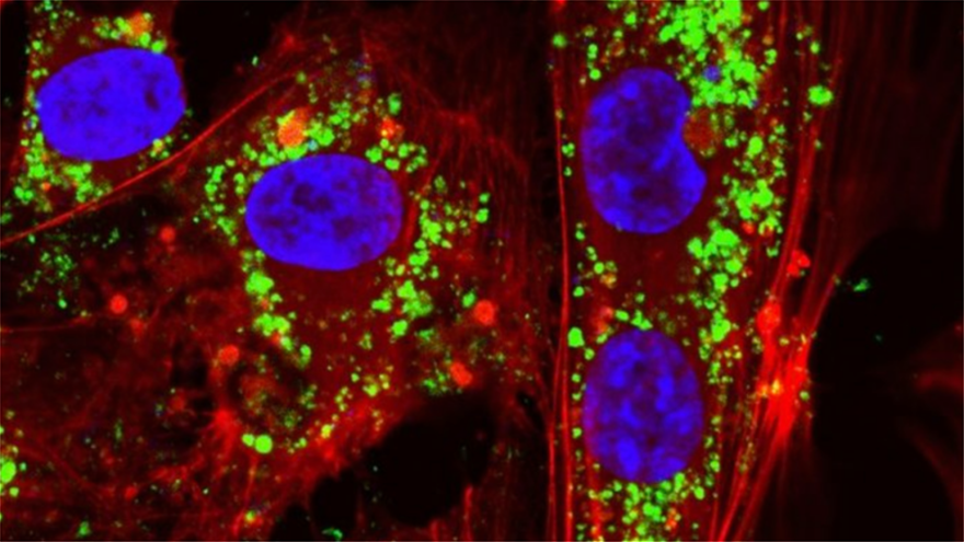 Βρέθηκε το «ελιξίριο της νιότης» στον Διεθνή Διαστημικό Σταθμό: Νανοσωματίδια επιδρούν κατά της γήρανσης των κυττάρων