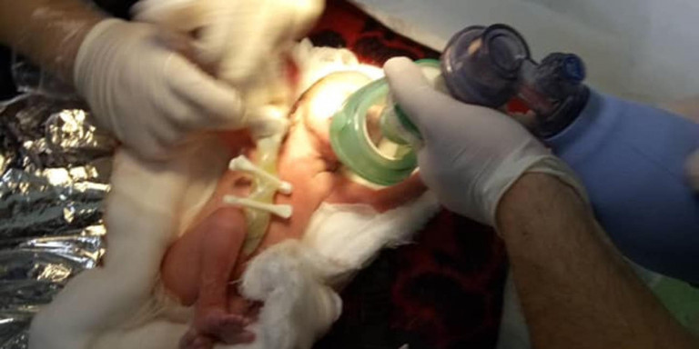 Γυναίκα γέννησε δίπλα στα διόδια με τη βοήθεια αστυνομικών και διασωστών (φώτο)