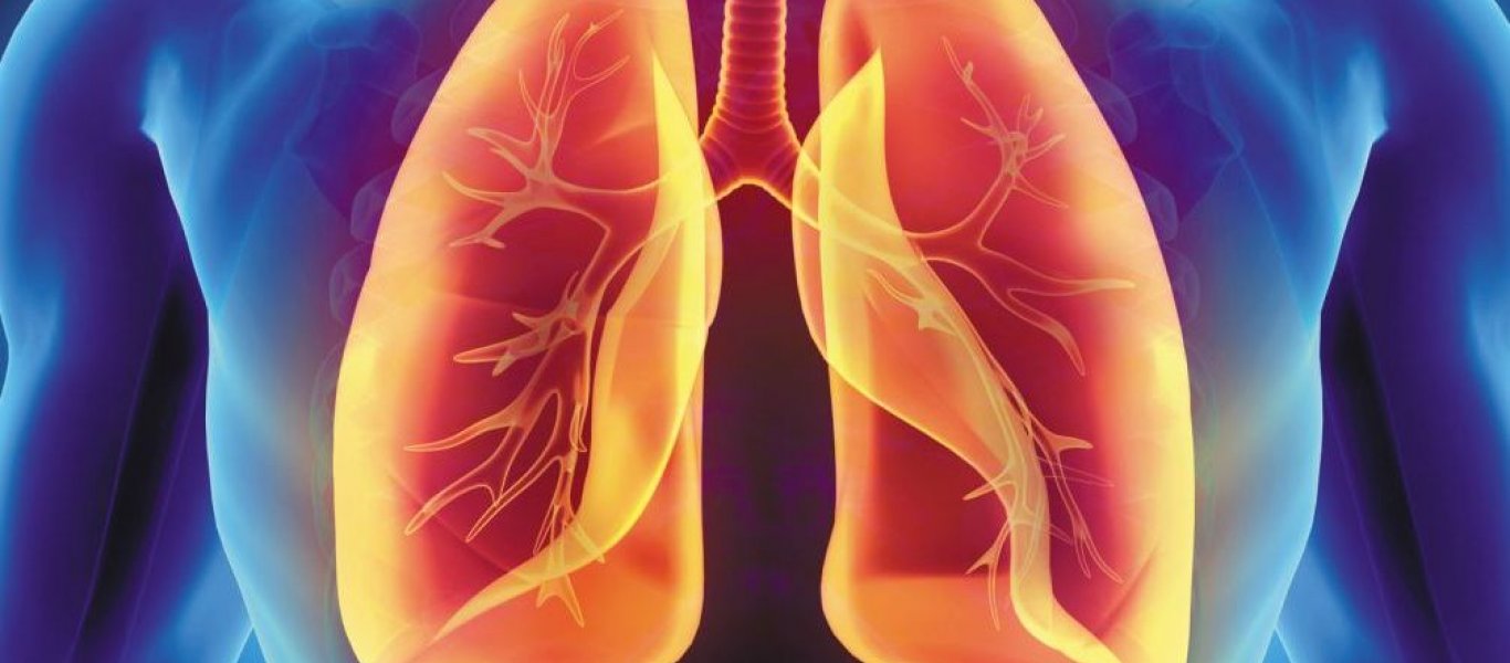Πνευμονικό οίδημα: Τα σημάδια που δείχνουν συσσώρευση υγρού στον πνεύμονα