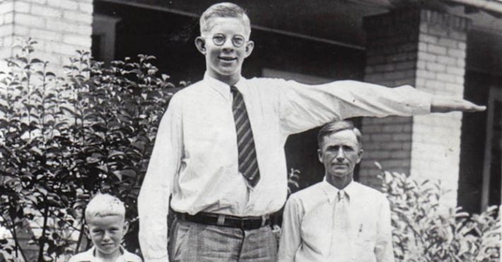 H άγνωστη ιστορία του γίγαντα που δεν έπρεπε να ψηλώσει άλλο – Πέθανε στα 22 του χρόνια