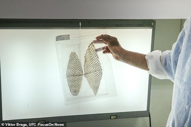 Τοποθέτησαν τεχνητό κόλπο φτιαγμένο από δέρμα ψαριού σε τρανς άτομο (φωτο)