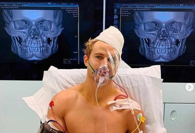 Sage Northcutt: Εννέα ώρες στο χειρουργείο μετά τον «κεραυνό»  του Cosmo Alexander