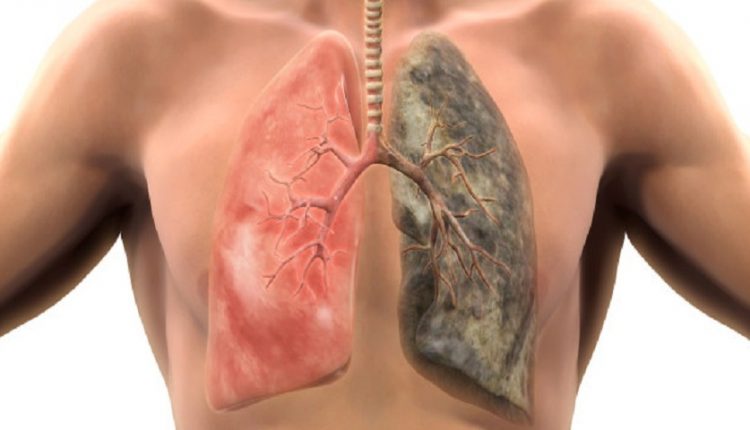 Τι θα συμβεί αφότου κόψετε το τσιγάρο – Πόσο θα χρειαστεί να «καθαρίσουν» οι πνεύμονες