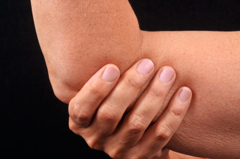 Ρευματοειδής αρθρίτιδα: Πέντε ανησυχητικά σημάδια ότι οι αρθρώσεις σας νοσούν