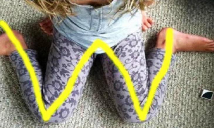 Αν δείτε το παιδί σας να κάθεται έτσι, σταματήστε το αμέσως – Δεν πάει ο νους σας γιατί… (βίντεο)