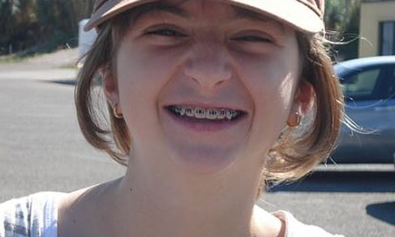 Η απόλυτη «μεταμόρφωση» – Την κορόιδευαν για το πόσο άσχημη είναι και τώρα όλοι την ποθούν! (φώτο)