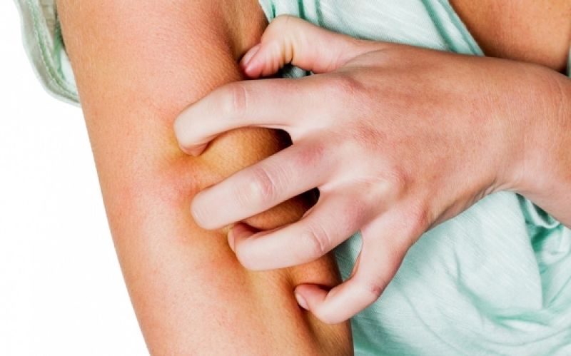 Ψώρα: Πώς θα καταλάβετε ότι έχετε πρόβλημα – Ποια θεραπεία υπάρχει