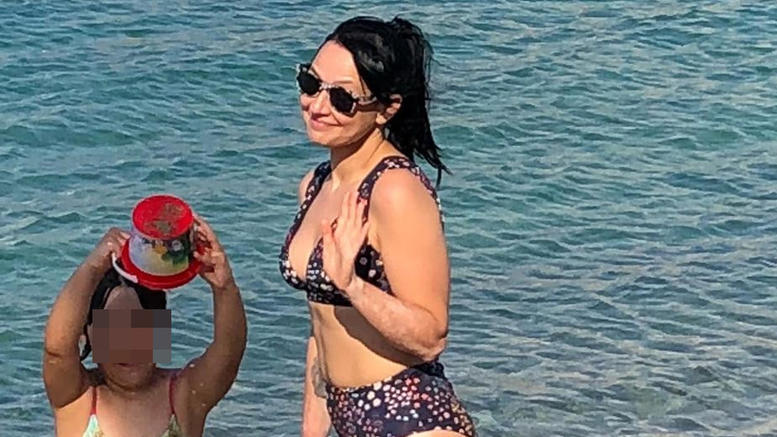 Αθηναΐς Νέγκα: Ποζάρει με μπικίνι και δείχνει τα σημάδια της λεύκης στο κορμί της! (φωτο)