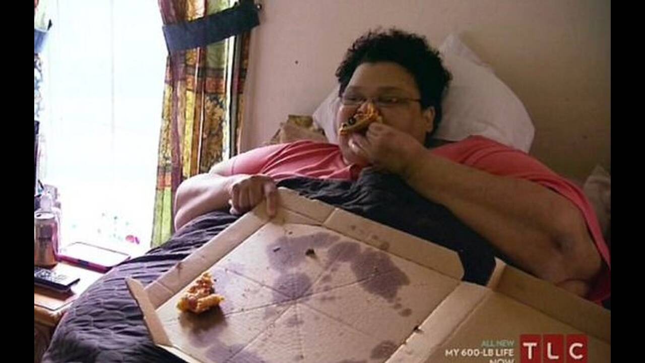 Σύγχρονο «θαύμα» – Η 51χρονη που έχασε 267 κιλά! Πλέον μπορεί και περπατά ξανά (φώτο-βίντεο)