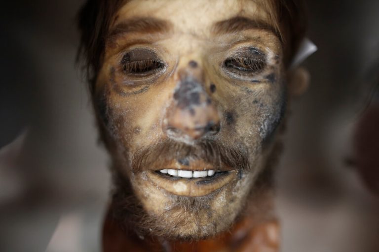 Μουσείο για «γερά» στομάχια – Το κεφάλι του Γιαγκούλα, κρανία, μούμιες και γκιλοτίνα! (φώτο)