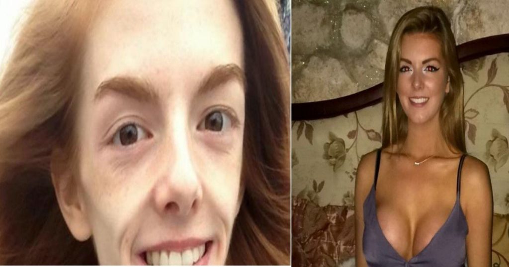 Πώς την έσωσε η… σοκολάτα – Ζύγιζε 30 κιλά (φωτο)