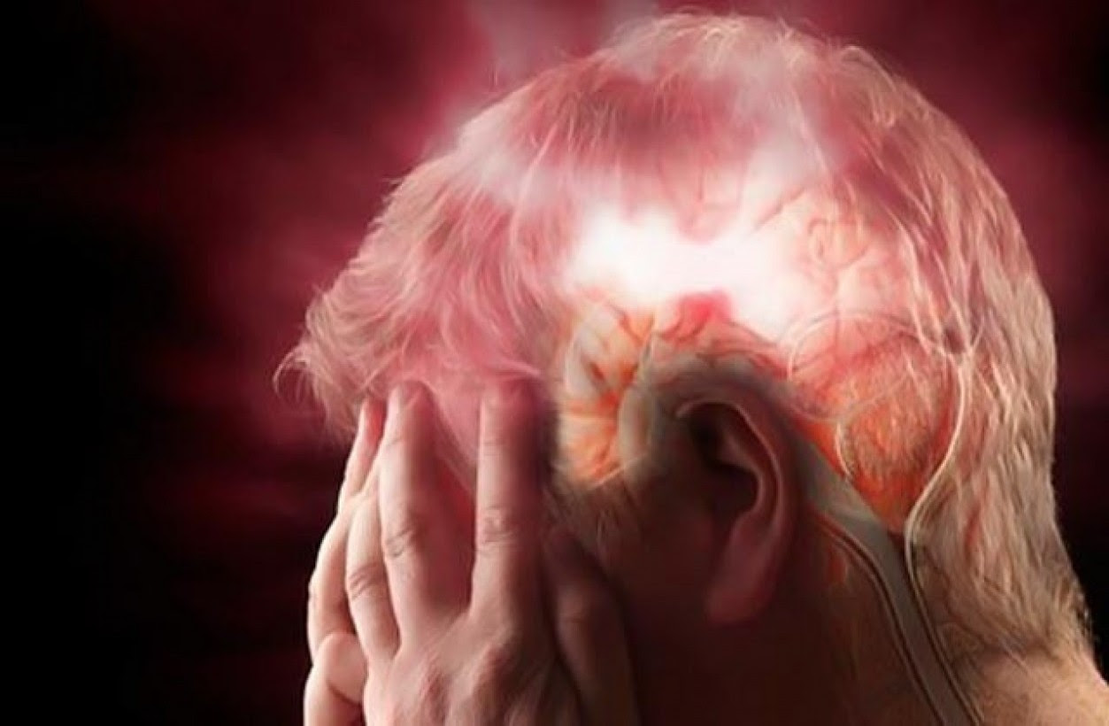 Ανεύρυσμα εγκεφάλου: Μην αγνοήσετε τα «αθώα» πρώιμα συμπτώματα