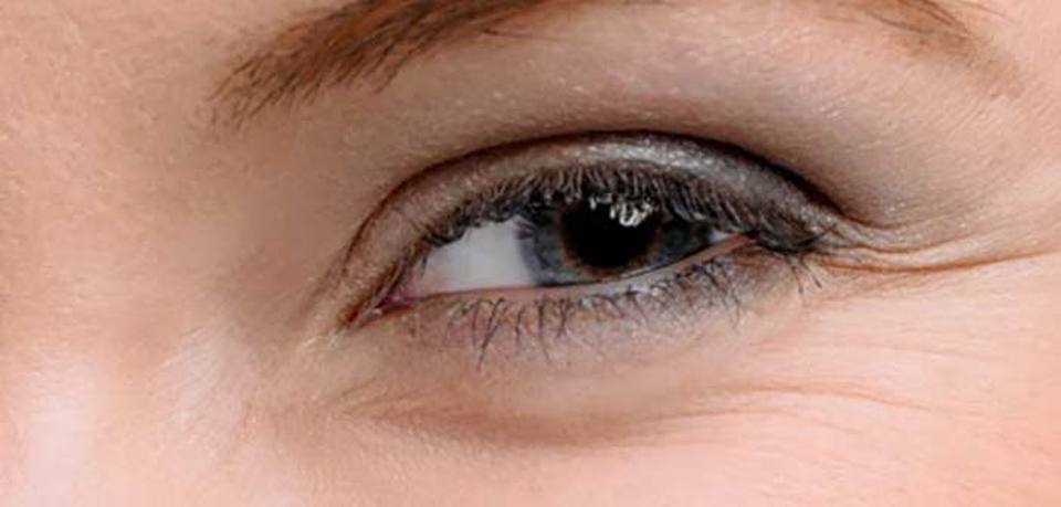 Γιατί οι ρυτίδες είναι πιο έντονες γύρω από τα μάτια