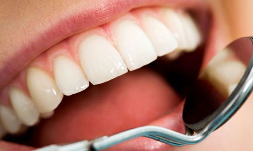 Πώς να αφαιρέσετε την οδοντική πλάκα χωρίς να πάτε στον οδοντίατρο!