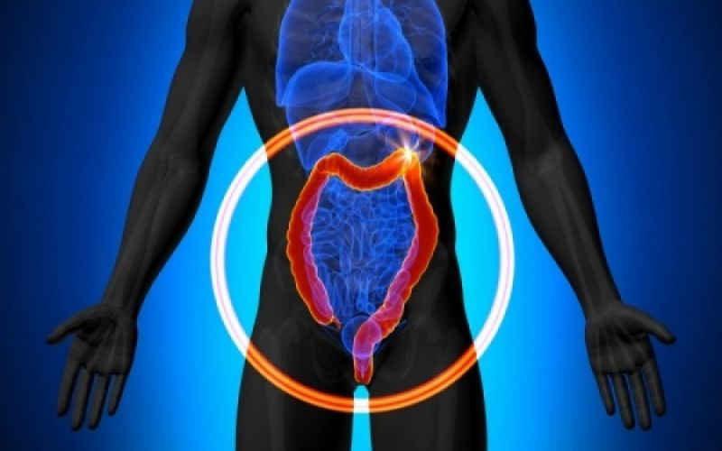 Οι επικίνδυνοι πολύποδες του παχέος εντέρου και πώς αντιμετωπίζονται