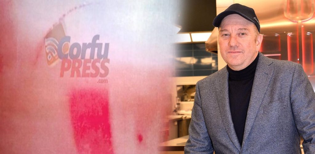 Υπόθεση Μποτρίνι: «Καταπέλτης» ο ιατροδικαστής – «Του έκαψαν τα χέρια!» (φωτο)