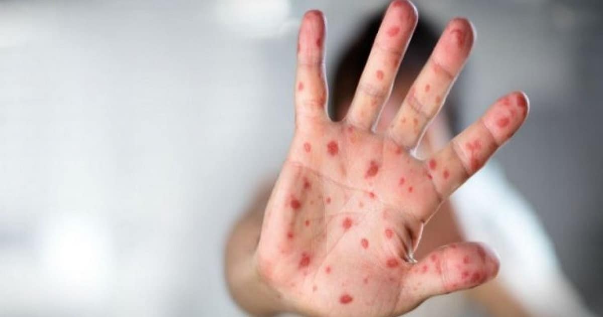 Aυτά τα σημάδια του καρκίνου αγνοούν όλοι