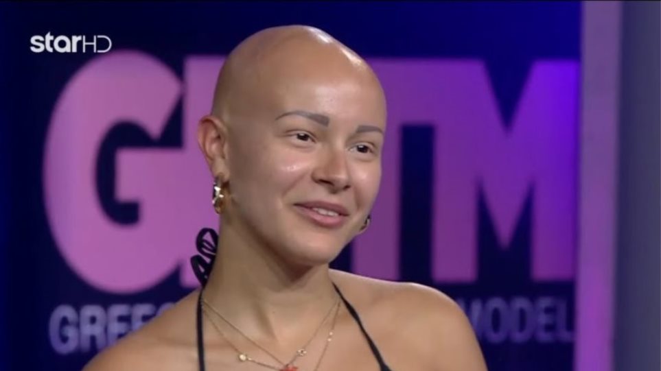 GNTM 2: Συγκίνησε τους πάντες η 21χρονη με την αλωπεκία! (βίντεο)