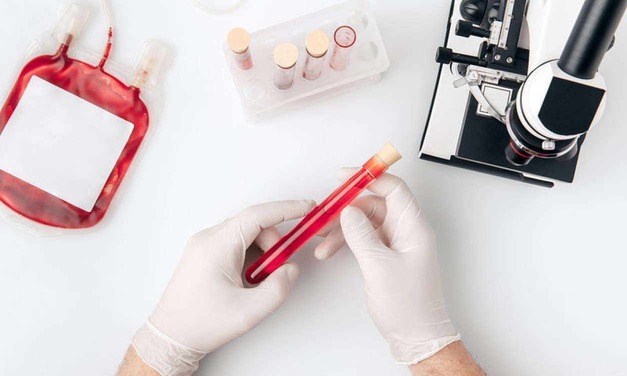 Χαμηλός και υψηλός αιματοκρίτης: Τι δείχνουν οι τιμές για την υγεία σας