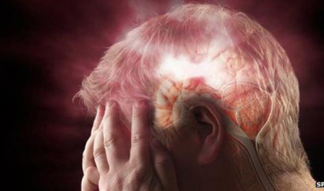 Βόλος: Τετραπλάσιος αριθμός εγκεφαλικών σε σχέση με την υπόλοιπη Ελλάδα – Ανησυχία των επιστημόνων