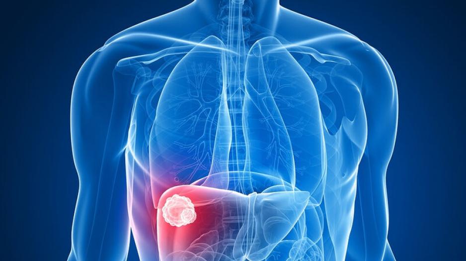 Καρκίνος στο ήπαρ: Ποια είναι τα σημάδια;