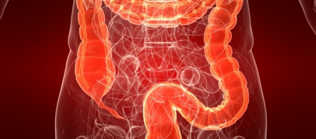 Αυτά είναι τα λαχανικά που προλαμβάνουν τον καρκίνο παχέος εντέρου